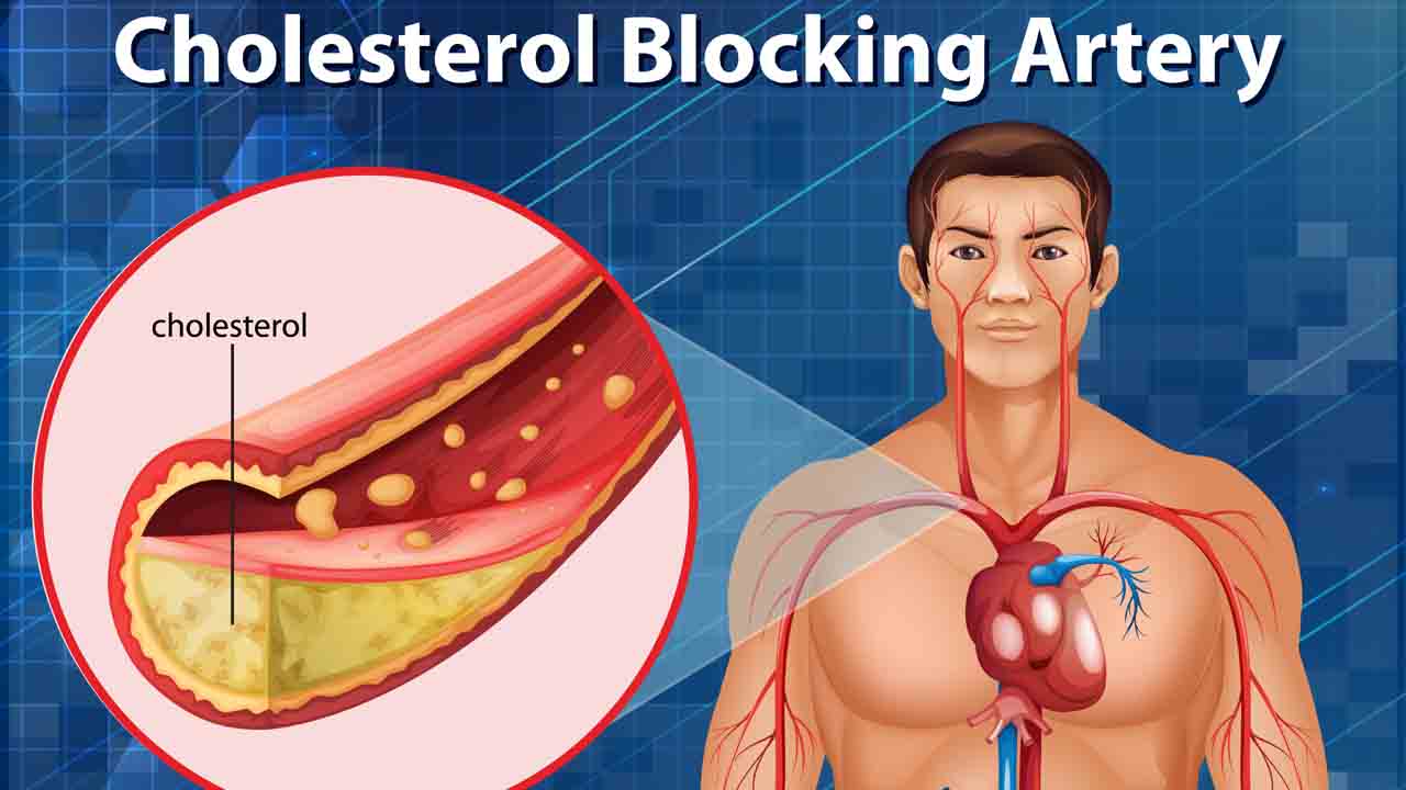 Cholesterol : 5 खाद्य पदार्थ खाने से आपके रक्त में कोलेस्ट्रॉल का स्तर कम हो जाएगा ।